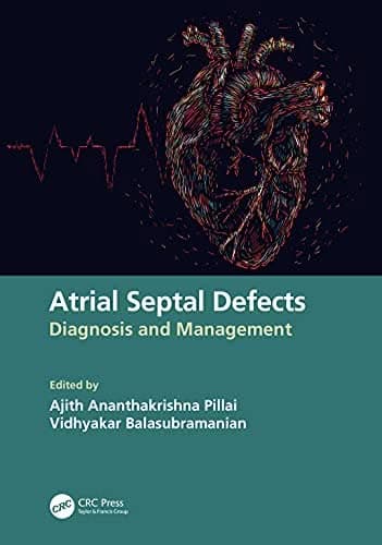 Atrial Septal Defects: Diagnosis and Management – PDF ebook