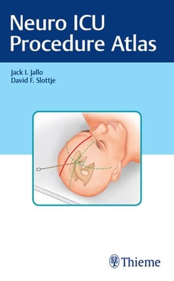 Neuro ICU Procedure Atlas – PDF ebook
