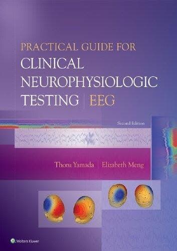 Practical Guide For Clinical Neurophysiologic Testing Eeg 2Nd Edition – PDF ebook