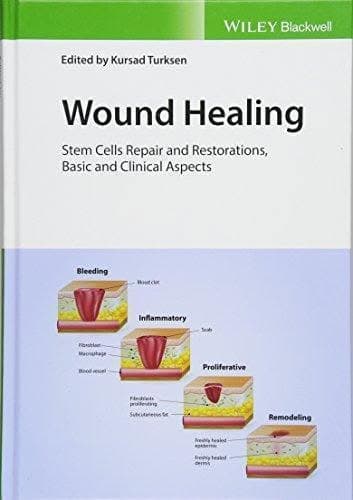 Wound Healing Stem Cells Repair And Restorations Basic And Clinical Aspects – PDF ebook