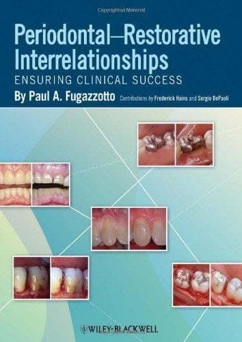 Periodontal Restorative Interrelationships – PDF ebook