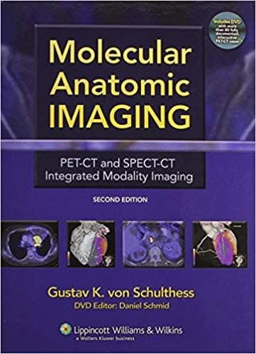 Molecular Anatomic Imaging: PET-CT and SPECT-CT Integrated Modality Imaging (2nd Edition) - eBook