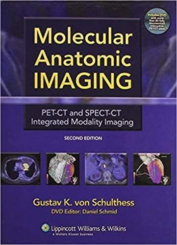 Molecular Anatomic Imaging: PET-CT and SPECT-CT Integrated Modality Imaging (2nd Edition) – PDF ebook