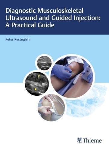 Diagnostic Musculoskeletal Ultrasound And Guided Injection A Practical Guide – PDF ebook