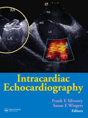 Intracardiac Echocardiography – PDF ebook