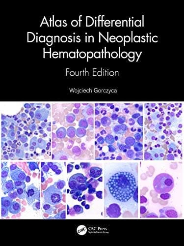Atlas of Differential Diagnosis in Neoplastic Hematopathology, 4th Edition – PDF ebook