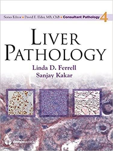 Liver Pathology (Consultant Pathology Book 4) – PDF ebook