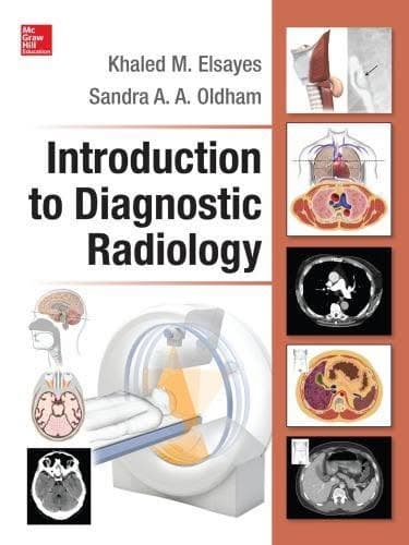 Introduction To Diagnostic Radiology – PDF ebook