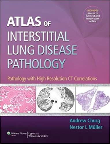 Atlas of Interstitial Lung Disease Pathology: Pathology with High Resolution CT Correlations – PDF ebook
