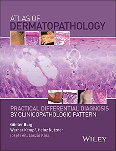 Atlas of Dermatopathology: Practical Differential Diagnosis by Clinicopathologic Pattern – PDF ebook