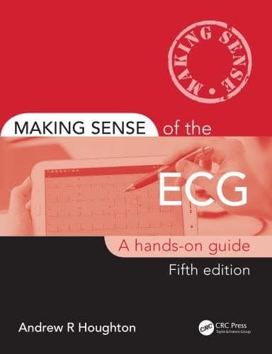 Making Sense Of The Ecg A Hands On Guide 5Th Edition – PDF ebook