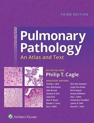 Pulmonary Pathology An Atlas And Text 3Rd Edition – PDF ebook