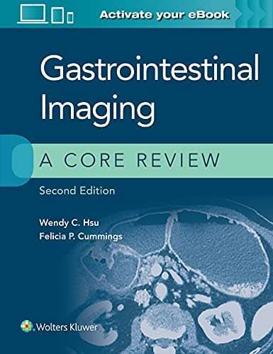 Gastrointestinal Imaging: A Core Review, 2nd Edition – PDF ebook