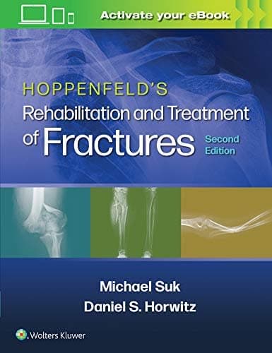 Hoppenfeld’s Treatment and Rehabilitation of Fractures, 2nd Edition – PDF ebook