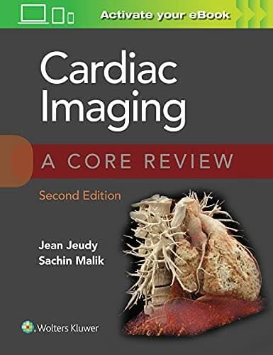 Cardiac Imaging: A Core Review, 2nd edition – PDF ebook