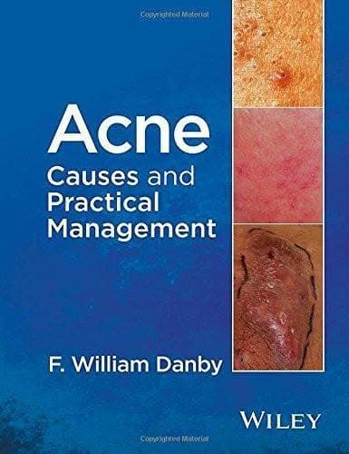 Acne Causes And Practical Management – PDF ebook