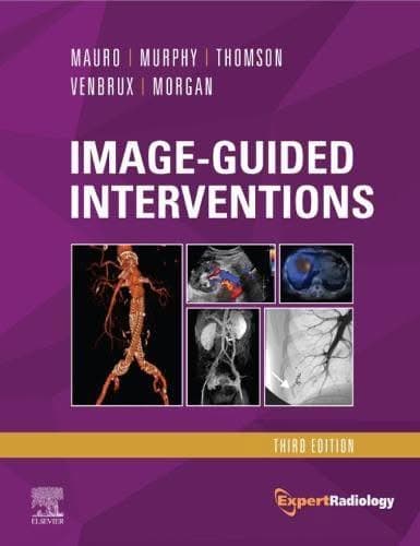Image Guided Interventions Expert Radiology Series 3Rd Edition – PDF ebook
