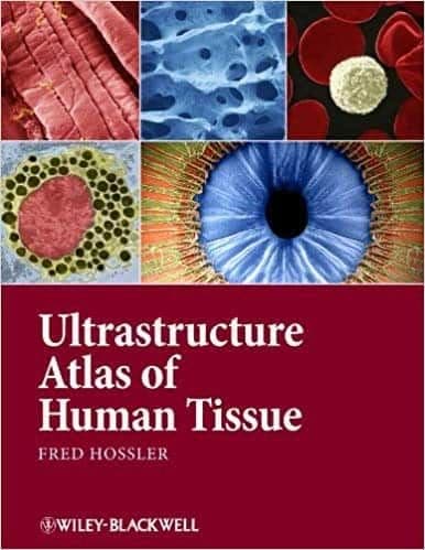 Ultrastructure Atlas of Human Tissues – PDF ebook