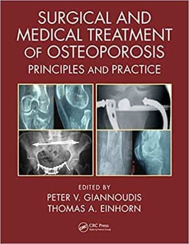 Surgical and Medical Treatment of Osteoporosis: Principles and Practice – PDF ebook
