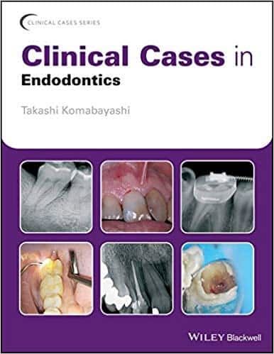 Clinical Cases in Endodontics – PDF ebook
