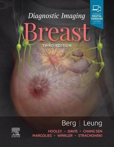 Diagnostic Imaging Breast 3Rd Edition – PDF ebook