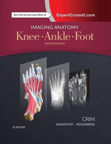 Imaging Anatomy Knee Ankle Foot 2Nd Edition – PDF ebook