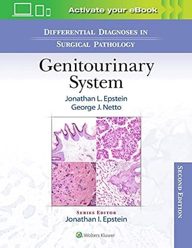 Differential Diagnoses in Surgical Pathology: Genitourinary System, 2nd edition – PDF ebook