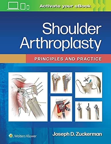 Shoulder Arthroplasty: Principles and Practice – PDF ebook
