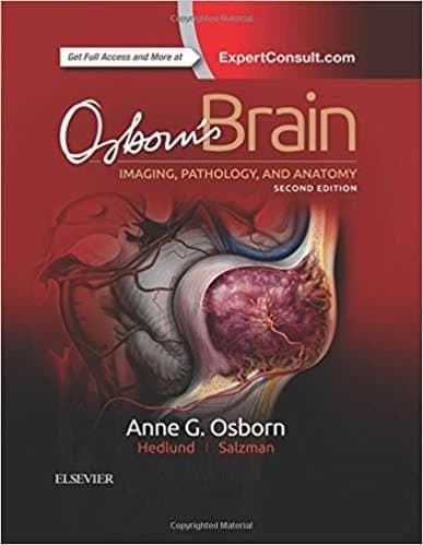 Osborn's Brain, 2nd Edition – PDF ebook