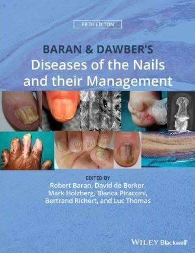 Baran Dawbers Diseases Of The Nails And Their Management 5Th Edition – PDF ebook