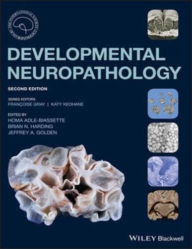 Developmental Neuropathology 2Nd Edition – PDF ebook