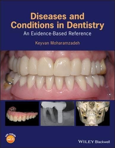 Diseases And Conditions In Dentistry An Evidence Based Reference – PDF ebook