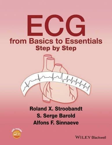 Ecg From Basics To Essentials Step – PDF ebook