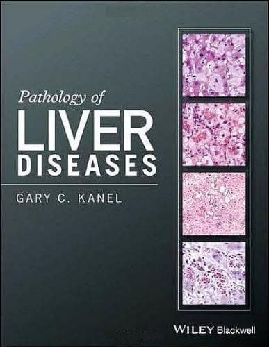 Pathology Of Liver Diseases – PDF ebook
