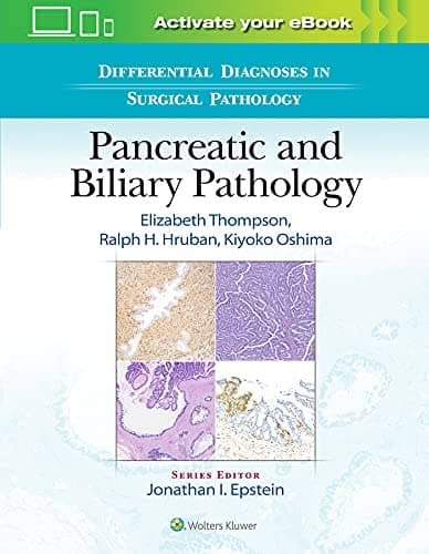 Differential Diagnoses in Surgical Pathology: Pancreatic and Biliary Pathology – PDF ebook