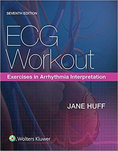 ECG Workout: Exercises in Arrhythmia Interpretation (7th Edition) – PDF ebook