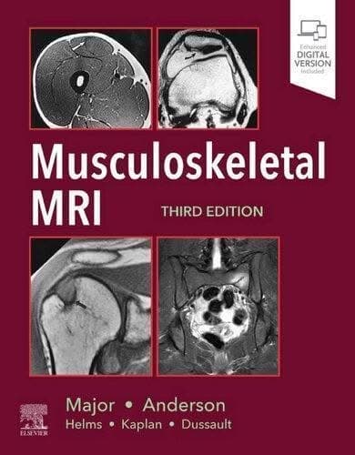 Musculoskeletal Mri 3Rd Edition – PDF ebook