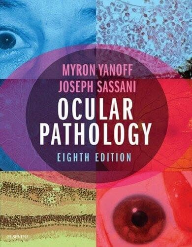 Ocular Pathology 8Th Edition – PDF ebook