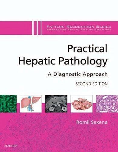 Practical Hepatic Pathology A Diagnostic Approach 2Nd Edition – PDF ebook