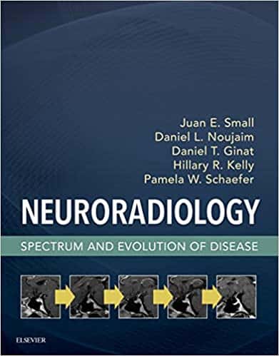 Neuroradiology: Spectrum and Evolution of Disease – PDF ebook