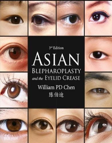Asian Blepharoplasty And The Eyelid Crease 3Rd Edition – PDF ebook