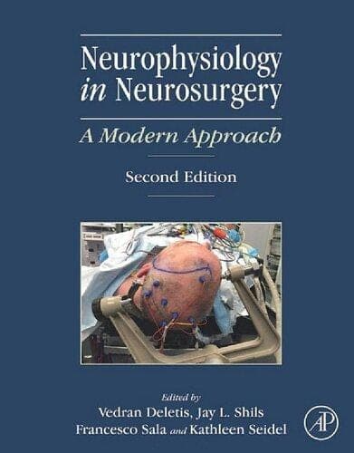 Neurophysiology In Neurosurgery A Modern Approach 2Nd Edition – PDF ebook