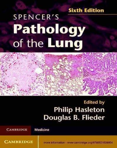 Spencers Pathology Of The Lung 6Th Edition – PDF ebook