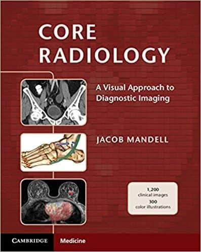 Core Radiology: A Visual Approach to Diagnostic Imaging – PDF ebook
