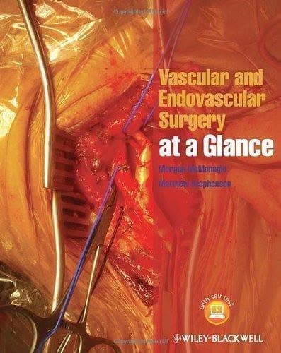 Vascular And Endovascular Surgery At A Glance – PDF ebook