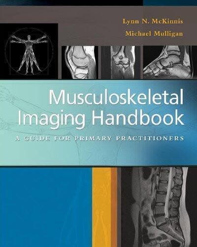 Musculoskeletal Imaging Handbook A Guide To Primary Practitioners – PDF ebook