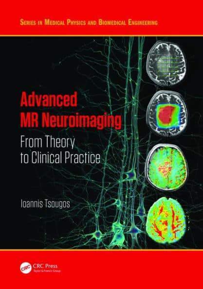 Advanced MR Neuroimaging: From Theory to Clinical Practice  Ioannis Tsougos – PDF ebook