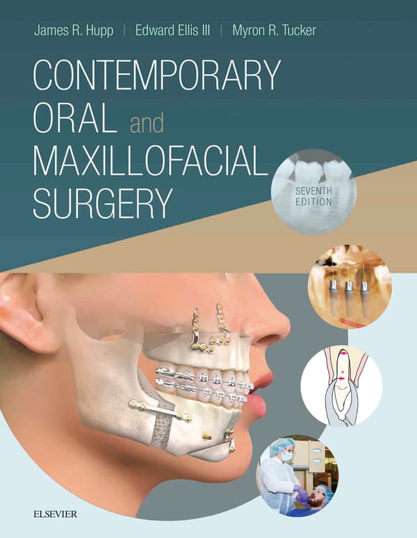 Contemporary Oral and Maxillofacial Surgery (7th Edition) - eBook