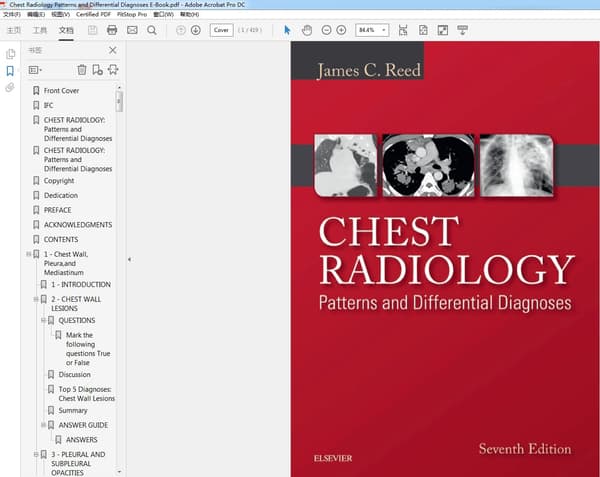 Chest Radiology Patterns and Differential Diagnoses – PDF ebook
