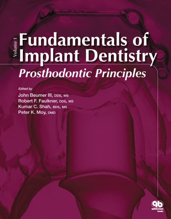 Fundamentals of Implant Dentistry: Prosthodontic Principles: Volume 1 – PDF ebook